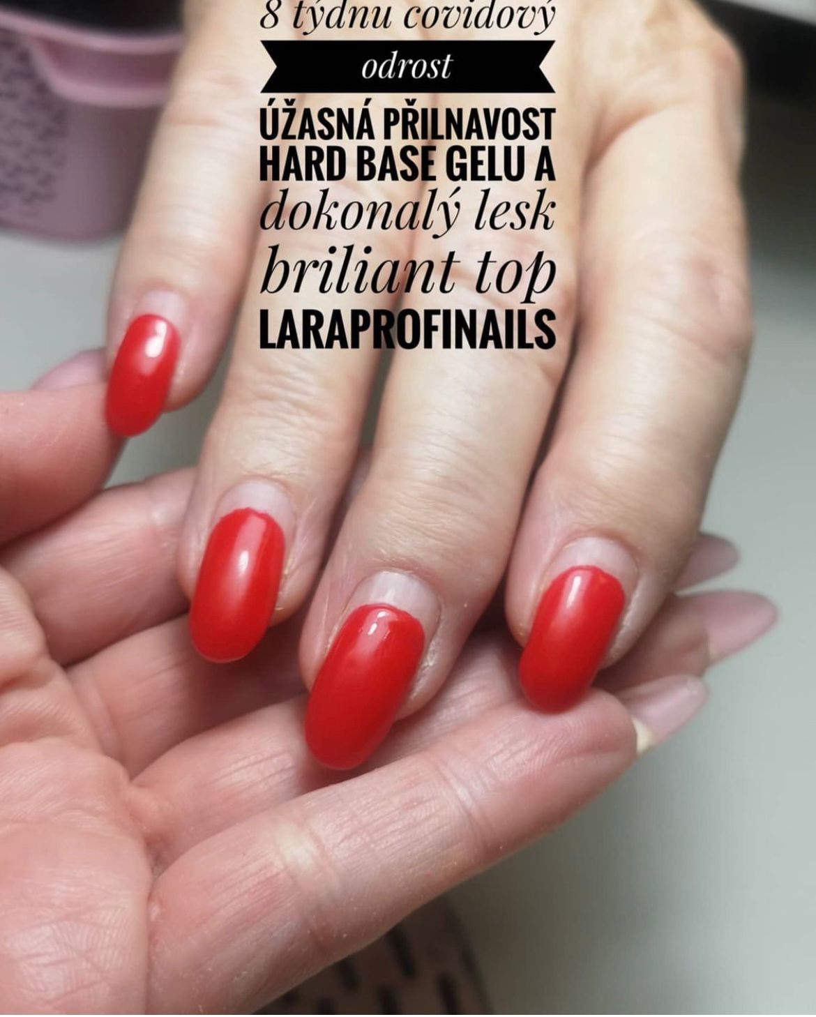 BRILLIANT TOP 10ML